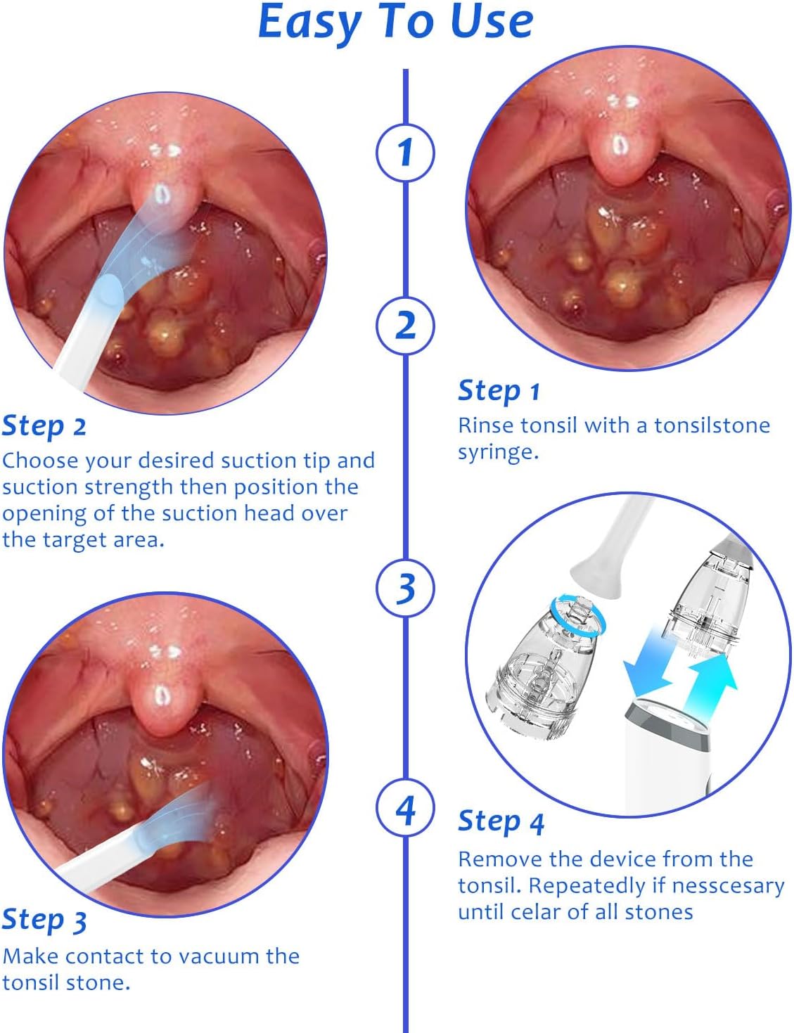 8 Suction Modes 3 Levels Tonsi - Electronics Repair And Maintenance のレビューと価格